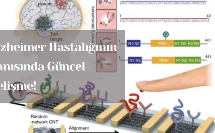 Alzheimer Hastalığının Tanısında Güncel Gelişme!
